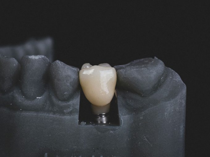 Dental Award