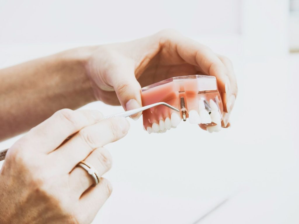 screw in teeth at dental clinic